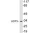 Uncoupling Protein 3 antibody, LS-C177228, Lifespan Biosciences, Western Blot image 