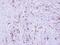 Collagen Type III Alpha 1 Chain antibody, GTX102997, GeneTex, Immunohistochemistry paraffin image 