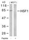 Heat Shock Transcription Factor 1 antibody, GTX50576, GeneTex, Western Blot image 