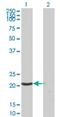 Zinc Ribbon Domain Containing 2 antibody, H00010534-M03, Novus Biologicals, Western Blot image 