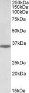 Neuroligin 4 X-Linked antibody, 43-069, ProSci, Enzyme Linked Immunosorbent Assay image 