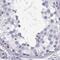 Adhesion G Protein-Coupled Receptor G2 antibody, PA5-65594, Invitrogen Antibodies, Immunohistochemistry frozen image 