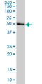 Transcriptional Adaptor 2B antibody, LS-C105195, Lifespan Biosciences, Western Blot image 