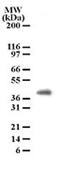 Peptidoglycan Recognition Protein 4 antibody, MA1-91734, Invitrogen Antibodies, Western Blot image 