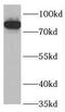 Colony Stimulating Factor 3 Receptor antibody, FNab03396, FineTest, Western Blot image 