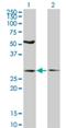 Intraflagellar Transport 57 antibody, H00055081-M04, Novus Biologicals, Western Blot image 