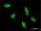 Transcription Factor AP-2 Beta antibody, H00007021-M01, Novus Biologicals, Immunocytochemistry image 