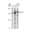 Carbamoyl-Phosphate Synthase 1 antibody, GTX03186, GeneTex, Western Blot image 