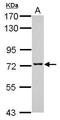 Transmembrane And Coiled-Coil Domains 3 antibody, GTX120621, GeneTex, Western Blot image 