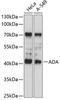 Adenosine Deaminase antibody, 15-263, ProSci, Western Blot image 