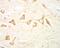 Leucine Rich Repeat Kinase 2 antibody, 45-848, ProSci, Immunohistochemistry paraffin image 
