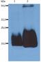 CD59 Molecule (CD59 Blood Group) antibody, GTX29183, GeneTex, Western Blot image 