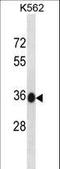 Metabolism Of Cobalamin Associated C antibody, LS-C157889, Lifespan Biosciences, Western Blot image 