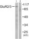 Glutamate Metabotropic Receptor 2 antibody, abx013091, Abbexa, Western Blot image 