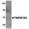 Anoctamin 1 antibody, MBS151482, MyBioSource, Western Blot image 