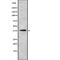 Interferon Gamma Receptor 2 antibody, abx216159, Abbexa, Western Blot image 