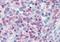 Unc-13 Homolog D antibody, NB100-1434, Novus Biologicals, Immunohistochemistry paraffin image 