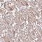 Transmembrane protein C3orf1 homolog antibody, NBP2-13433, Novus Biologicals, Immunohistochemistry paraffin image 