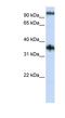 Ferric Chelate Reductase 1 Like antibody, NBP1-59961, Novus Biologicals, Western Blot image 