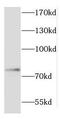 Coilin antibody, FNab01833, FineTest, Western Blot image 