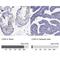 Ly1 Antibody Reactive antibody, NBP1-86827, Novus Biologicals, Immunohistochemistry paraffin image 