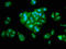 Serpin Family A Member 6 antibody, LS-C317800, Lifespan Biosciences, Immunofluorescence image 