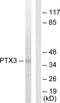Pentraxin 3 antibody, LS-C118838, Lifespan Biosciences, Western Blot image 