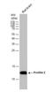 Profilin 2 antibody, NBP1-31629, Novus Biologicals, Western Blot image 