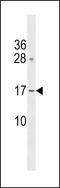 GRB2 Binding Adaptor Protein, Transmembrane antibody, LS-C157762, Lifespan Biosciences, Western Blot image 