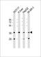 Aldo-Keto Reductase Family 7 Member A3 antibody, M10277, Boster Biological Technology, Western Blot image 