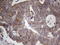 Dicer 1, Ribonuclease III antibody, LS-C338516, Lifespan Biosciences, Immunohistochemistry paraffin image 