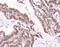 Exportin 1 antibody, M01180, Boster Biological Technology, Immunohistochemistry paraffin image 