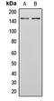 PEAK1 Related, Kinase-Activating Pseudokinase 1 antibody, LS-C353873, Lifespan Biosciences, Western Blot image 