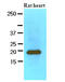 Myosin regulatory light chain 2, ventricular/cardiac muscle isoform antibody, AM09080PU-N, Origene, Western Blot image 