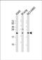 Tumor Suppressor Candidate 1 antibody, PA5-72313, Invitrogen Antibodies, Western Blot image 