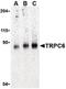 Transient Receptor Potential Cation Channel Subfamily C Member 6 antibody, LS-B611, Lifespan Biosciences, Western Blot image 