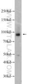 Mitogen-activated protein kinase kinase kinase kinase 1 antibody, 23950-1-AP, Proteintech Group, Western Blot image 