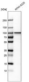 Coiled-Coil Domain Containing 39 antibody, NBP1-90560, Novus Biologicals, Western Blot image 