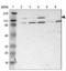 Phosphorylase Kinase Regulatory Subunit Alpha 1 antibody, NBP1-87281, Novus Biologicals, Western Blot image 