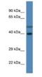 Hydroxysteroid Dehydrogenase Like 1 antibody, NBP1-74267, Novus Biologicals, Western Blot image 