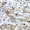 Down-Regulator Of Transcription 1 antibody, A6903, ABclonal Technology, Immunohistochemistry paraffin image 