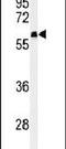 FAM20A Golgi Associated Secretory Pathway Pseudokinase antibody, PA5-24891, Invitrogen Antibodies, Western Blot image 