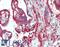 Protein Arginine Methyltransferase 9 antibody, LS-C290833, Lifespan Biosciences, Immunohistochemistry paraffin image 