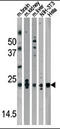 Parkinsonism Associated Deglycase antibody, AP13481PU-N, Origene, Western Blot image 