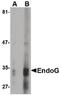 Endonuclease G antibody, MA5-15756, Invitrogen Antibodies, Western Blot image 