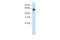 AT-Rich Interaction Domain 3B antibody, 28-043, ProSci, Western Blot image 