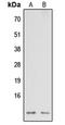 NADH:Ubiquinone Oxidoreductase Subunit A3 antibody, GTX56108, GeneTex, Western Blot image 