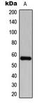 Cyclin Dependent Kinase Like 2 antibody, LS-C354120, Lifespan Biosciences, Western Blot image 