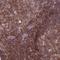 Interleukin 1 Receptor Associated Kinase 3 antibody, HPA043097, Atlas Antibodies, Immunohistochemistry frozen image 