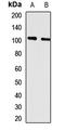 G Protein-Coupled Receptor Class C Group 6 Member A antibody, LS-C668682, Lifespan Biosciences, Western Blot image 